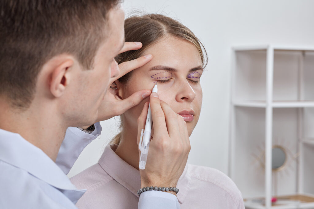 A woman is at a Cosmetic Surgery Affiliates consultation for a blepharoplasty near Fruit Cove and her surgeon is making marks around her eyelids to create a plan for surgery.