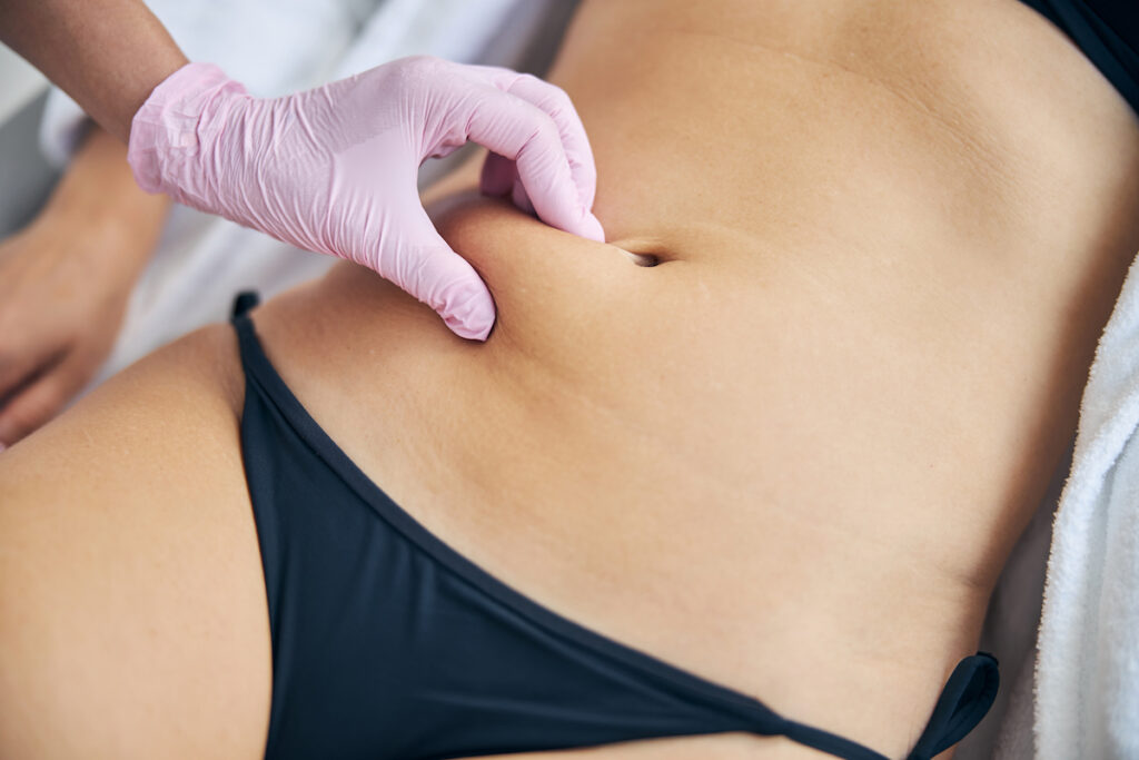 A woman is lying down and a doctor is examining her stomach for abdominoplasty in Jacksonville.