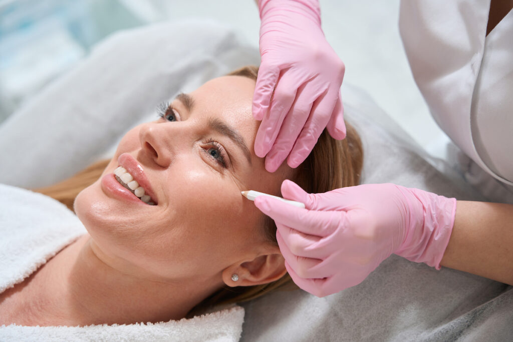 A woman is lying down and a practitioner is drawing on her face wit a skin-safe marker to create plan for her facelift in Jacksonville.