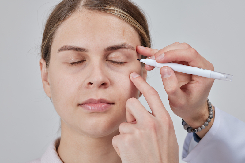 A woman is at a Cosmetic Surgery Affiliates consultation for a blepharoplasty near Fruit Cove and her surgeon is making marks around her eyelids to create a plan for surgery.