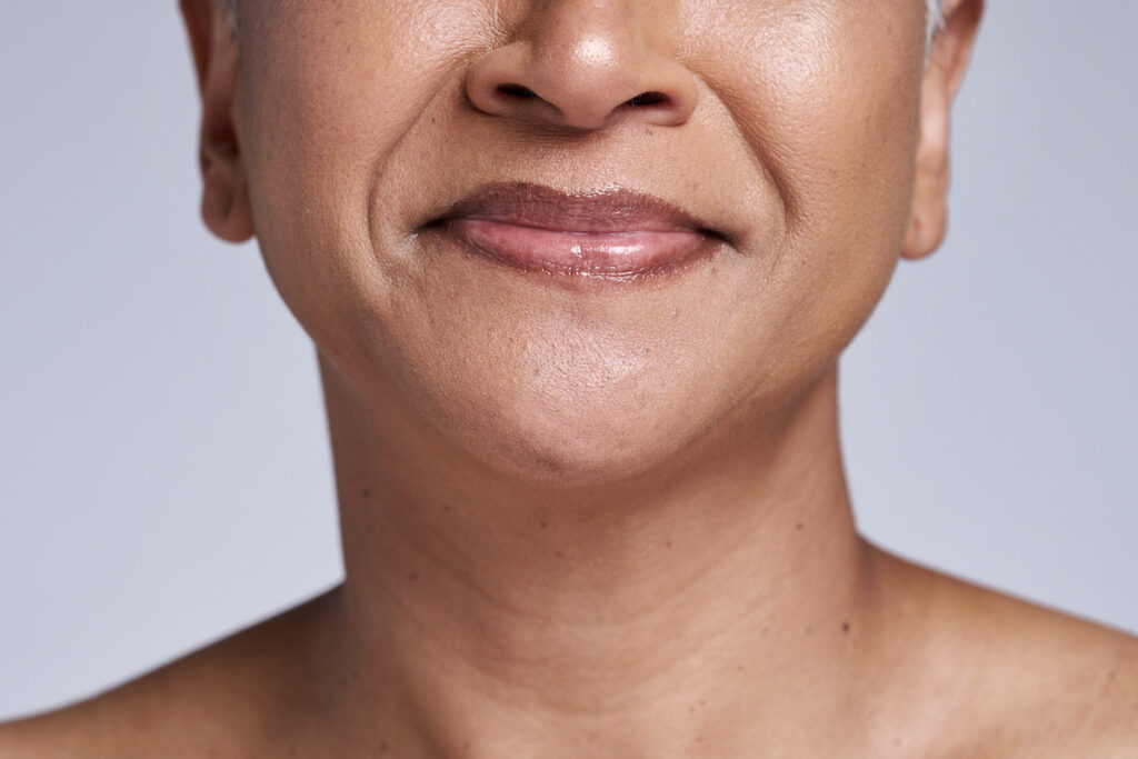 A woman is soft smiling and showing off the results from her double chin removal Jacksonville.