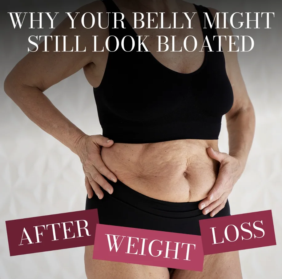 Are you a good candidate for skin removal surgery?