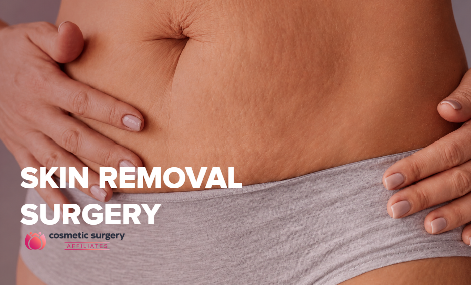 Complete Guide to Skin Removal Surgery: Everything You Need to Know
