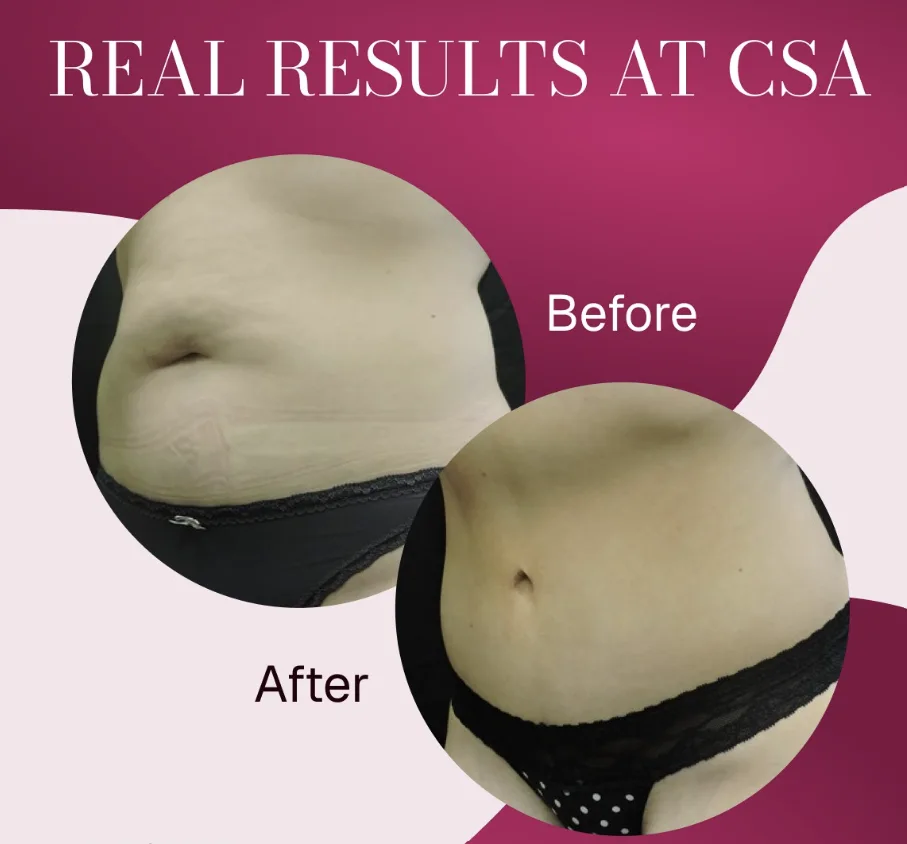 How do you read before-and-after photos to judge a surgeon's skill? REDO