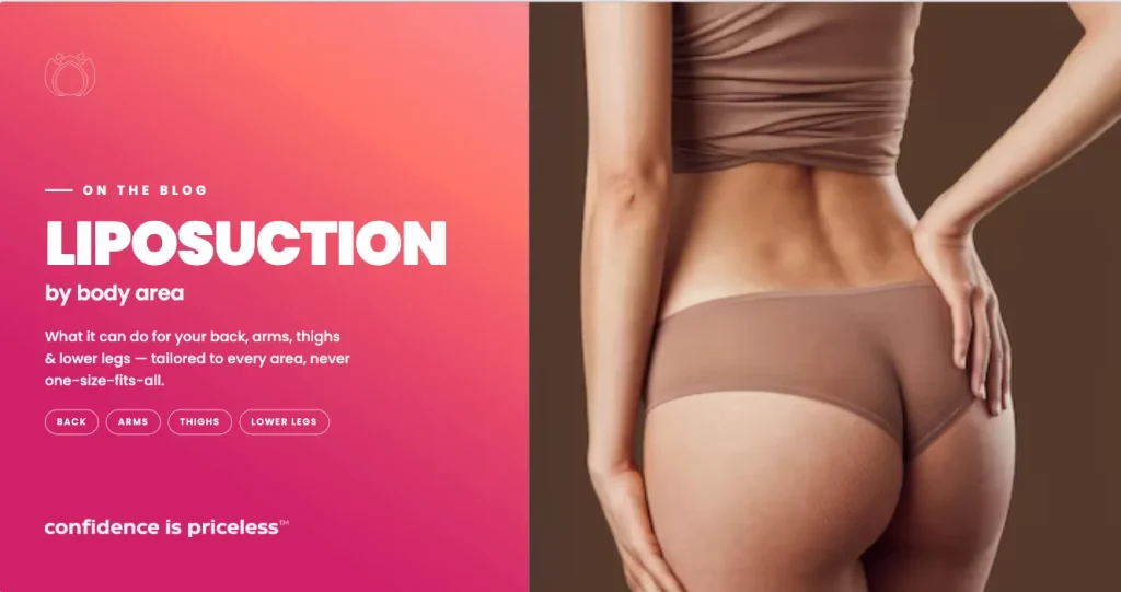 Liposuction by Body Area: What It Can Do for Your Back, Arms, Thighs, and More