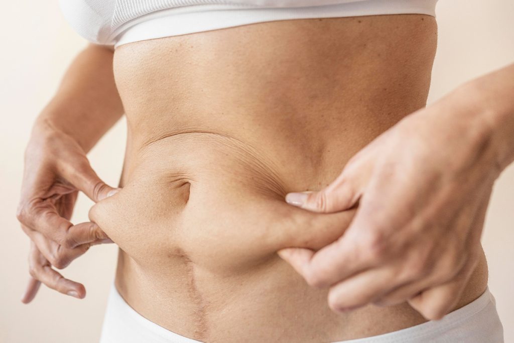 The Best Tummy Tuck in Oklahoma Is by Dr. Erik Nuveen