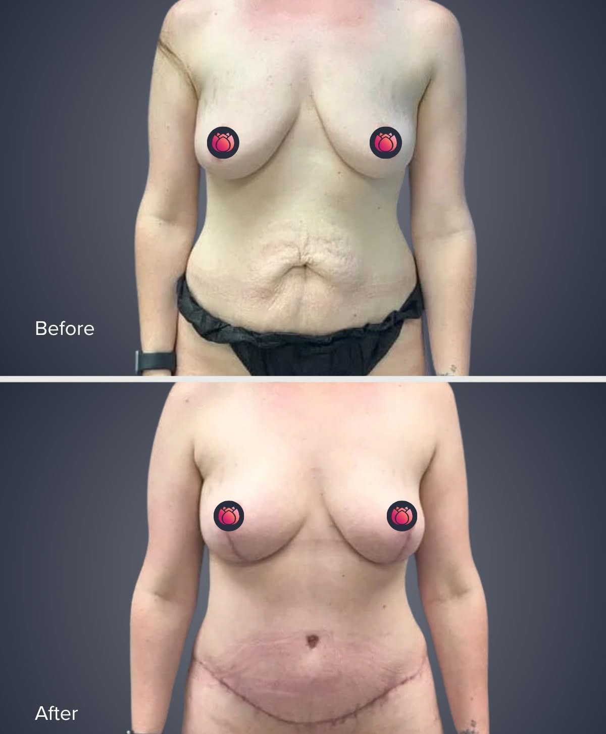 before and after real patient result at CSA
