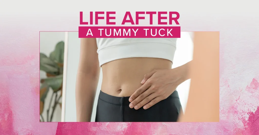 life after a tummy tuck what are the results like years later